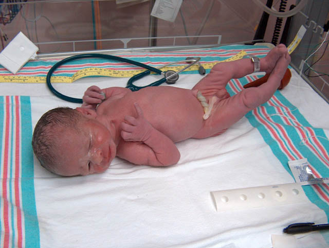 It's too bright out here to open both eyes!