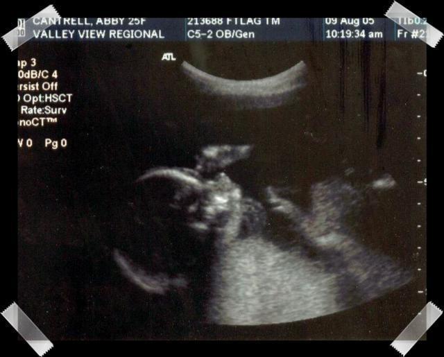 Pic of the Week ~ 8/14/05 (20 week ultrasound picture)
