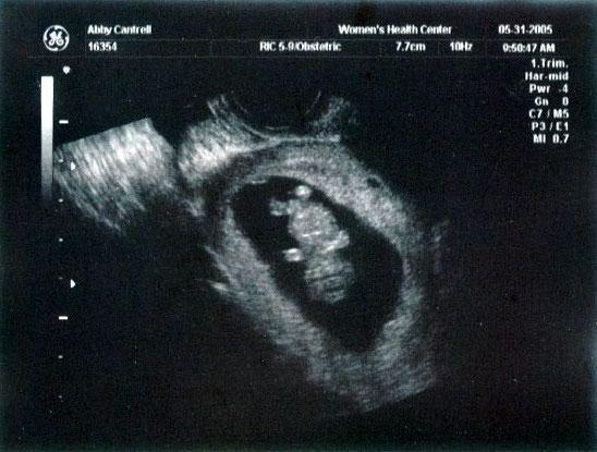 10 week ultrasound ~ There's a BABY in there!