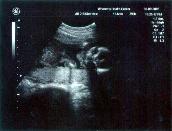 20 week ultrasound ~ Our adorable little alien!