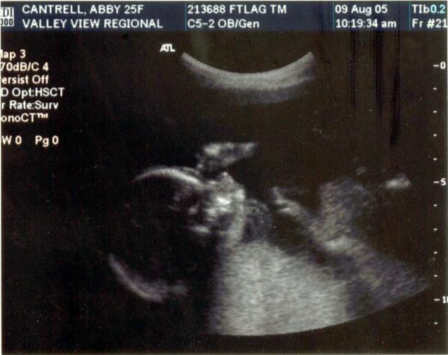 20 week ultrasound ~ Baby's profile with hand up by his or her face