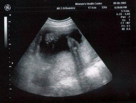 24 week ultrasound ~ Baby's leg and foot -- all 5 toes present and accounted for!