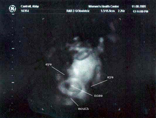 33 week ultrasound ~ Eyes, nose and mouth labeled because it really is hard to see what you're looking at, even if you know what's it's supposed to be!