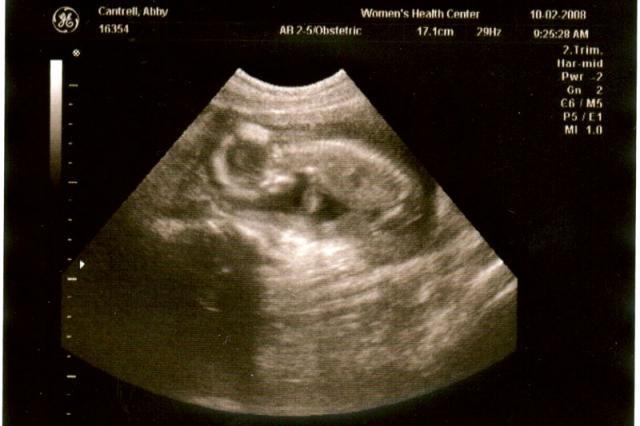 16 week ultrasound