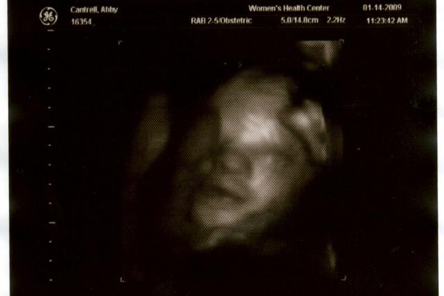 3D ultrasound, 31 weeks -- trying to hide behind a hand or a foot