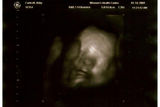 3D ultrasound, 31 weeks -- still trying to hide