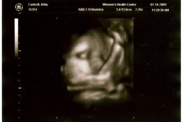 3D ultrasound, 31 weeks -- Okay, show's over, night night!